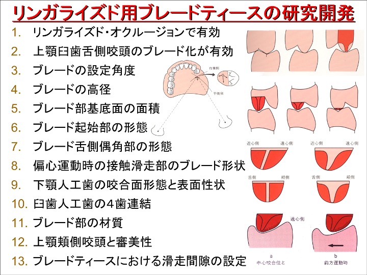 リンガライズド用ブレードティースの研究開発
