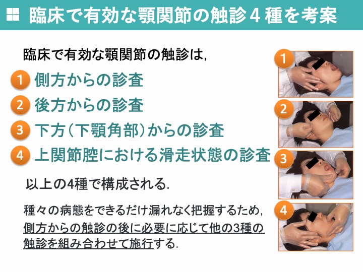 臨床で有効な顎関節の触診4種を考案