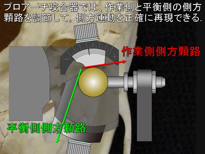 プロアーチでは作業側と平衡側の側方顆路を調節して側方運動を正確に再現できる