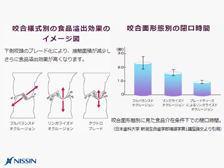 咬合様式別の食品溢出効果のイメージ図