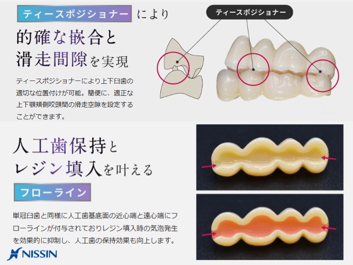 人工歯保持とレジン填入をかなえるフローライン