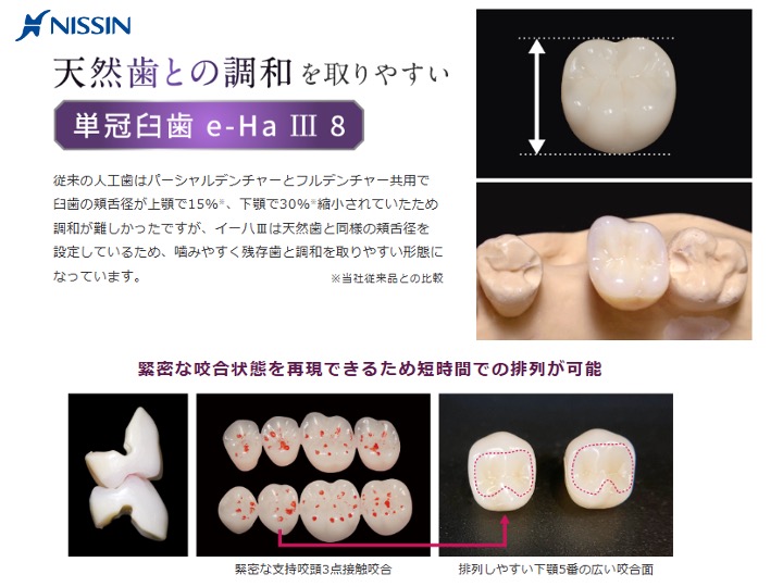 天然歯との調和を取りやすい　単冠臼歯e-Ha Ⅲ 8
