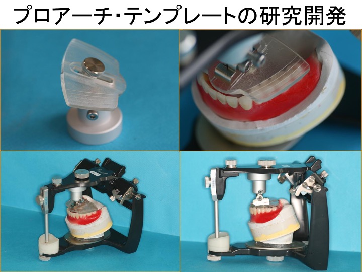 プロアーチ・テンプレートの研究開発