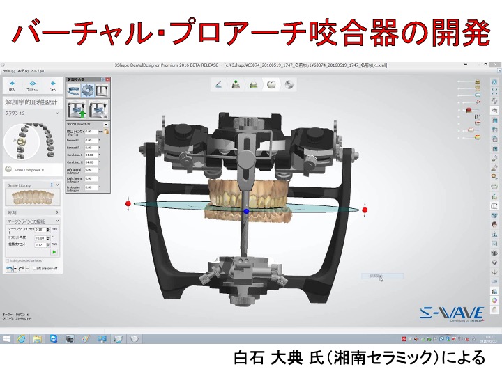 バーチャル・プロアーチ咬合器の開発