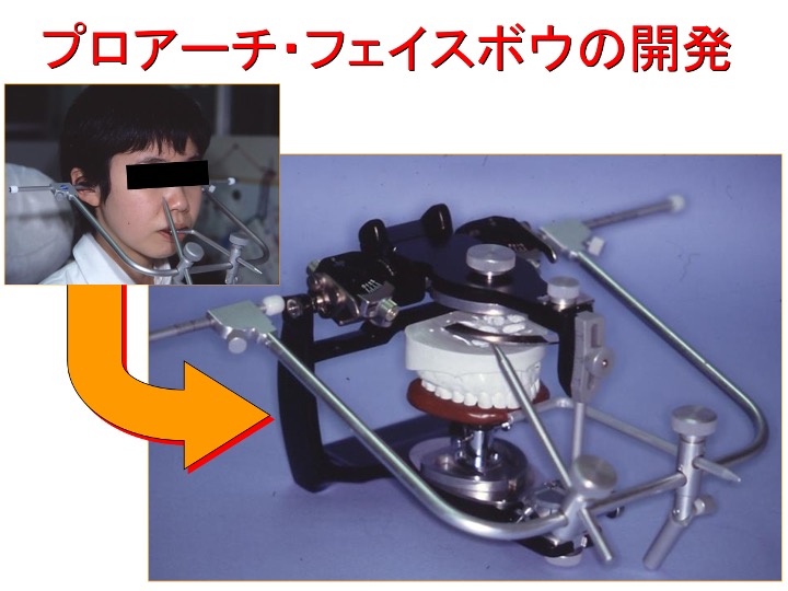 プロアーチ・フェイスボウの開発