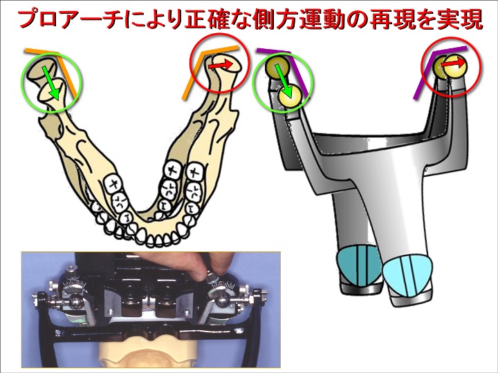 プロアーチにより正確な側方運動の再現を実現