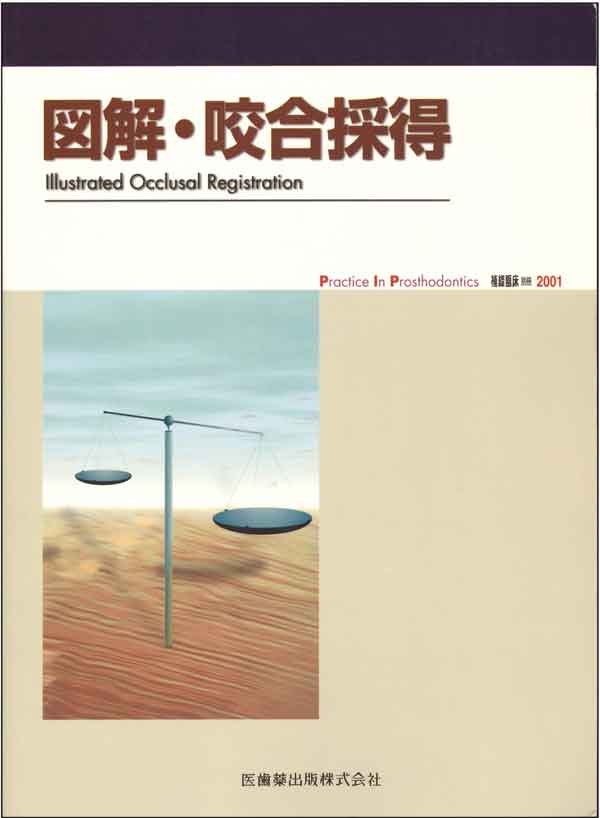 図解・咬合採得