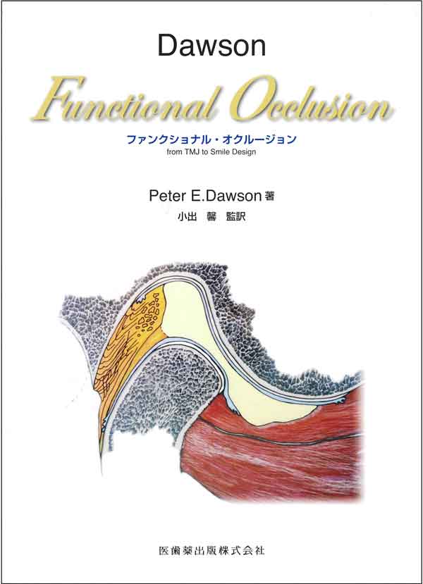 Dawson Functional Occlusion ファンクショナル・オクルージョン