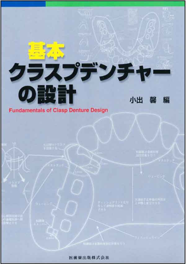 基本 クラスプデンチャーの設計