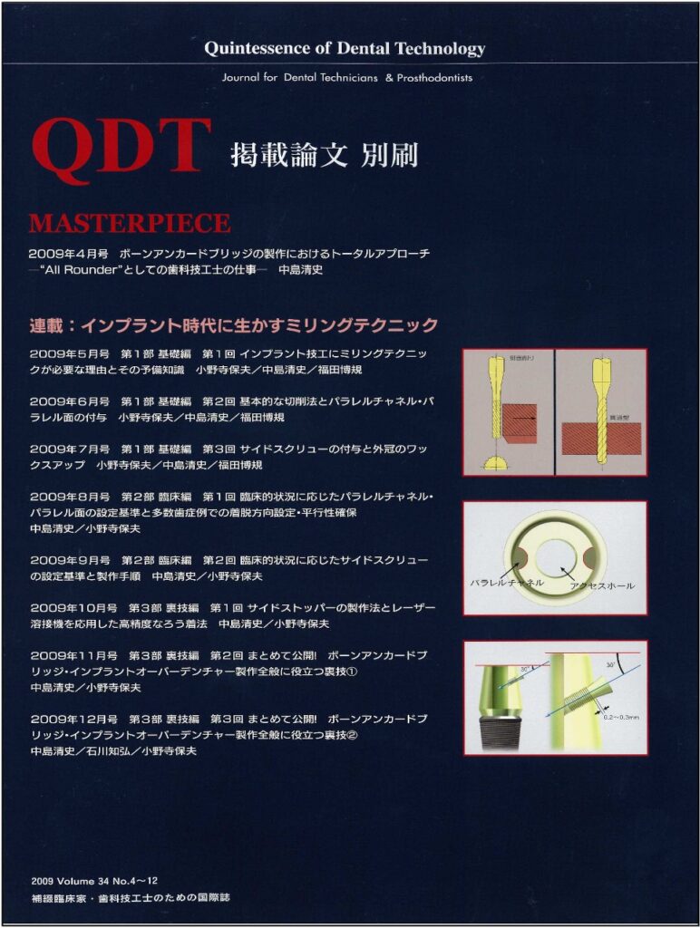 QDT