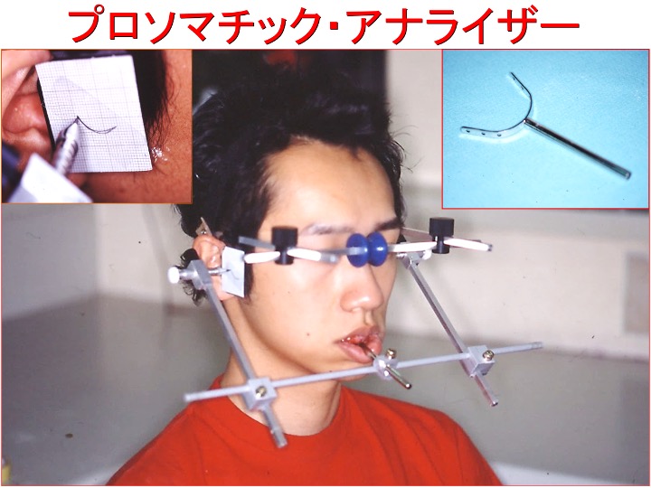 プロソマチック・アナライザー