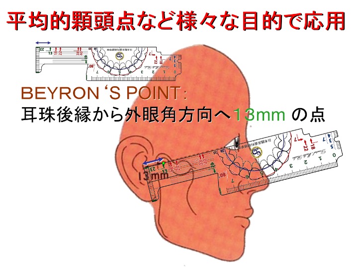平均的顆頭点など様々な目的で応用