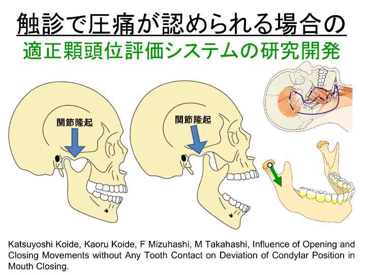 触診で圧痛が認められる場合の適正顆頭位評価システムの研究開発