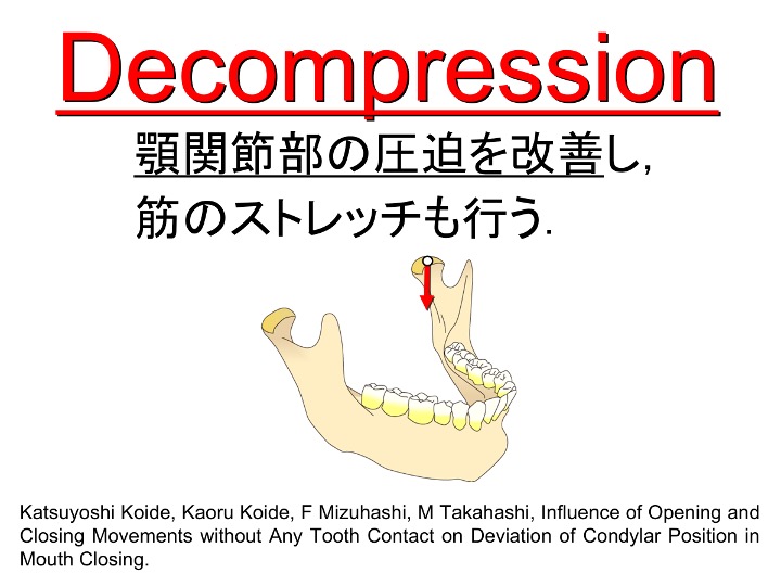 Decompression 顎関節部の圧迫を改善し、筋のストレッチも行う