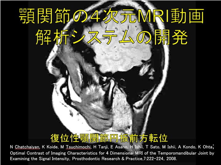 顎関節の４次元MRI動画解析システムの開発