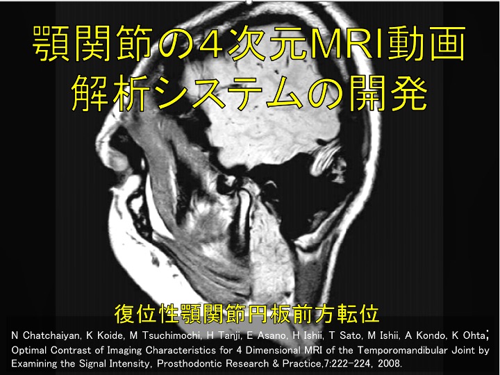 顎関節の４次元MRI動画解析システムの開発