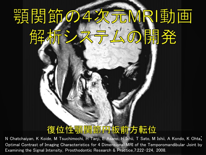顎関節の４次元MRI動画解析システムの開発
