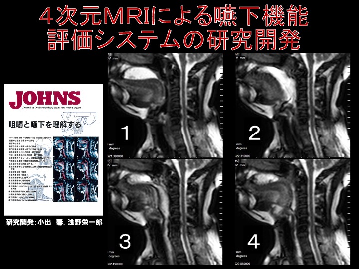 ４次元MRIによる嚥下機能評価システムの研究開発