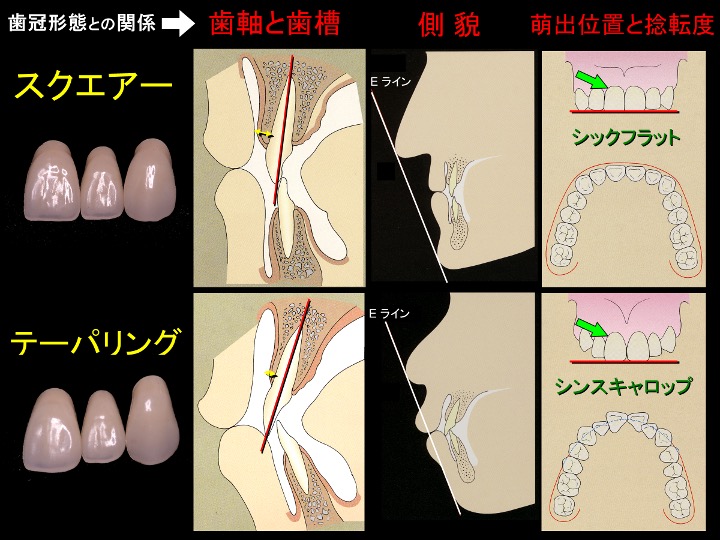 歯冠形態との関係