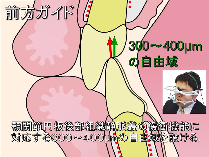 前方ガイド