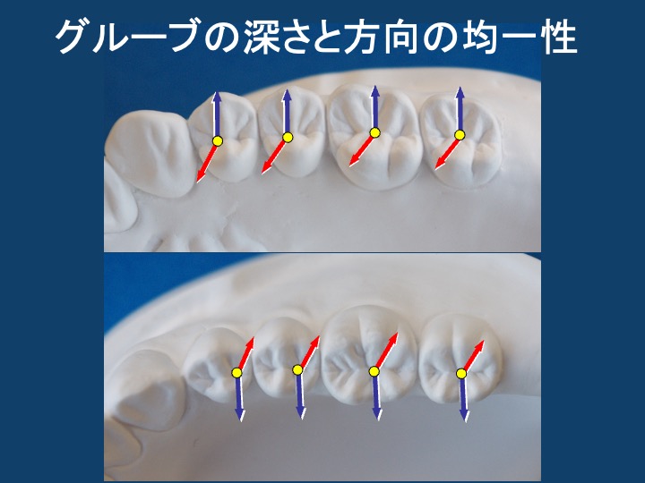 グルーブの深さと方向の均一性