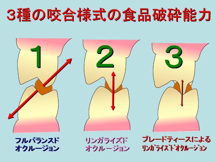 3種咬合様式の食品破砕能力