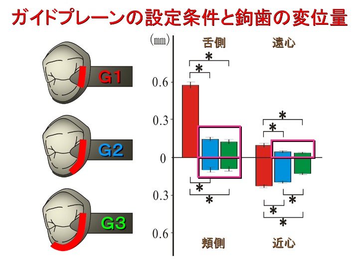 ガイドプレーンの設定条件と鉤歯の変位量